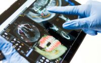 Implantátum típusok és altatásos fogászat